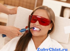 Отбеливание зубной эмали: все, о чем вы и не догадывались