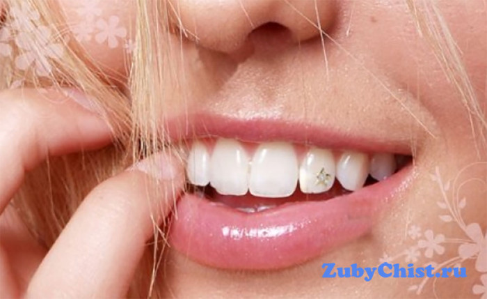 Фигурки в форме звезд для зубов