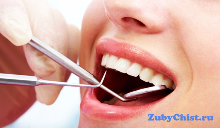 Удаляют налет зуба наконечником