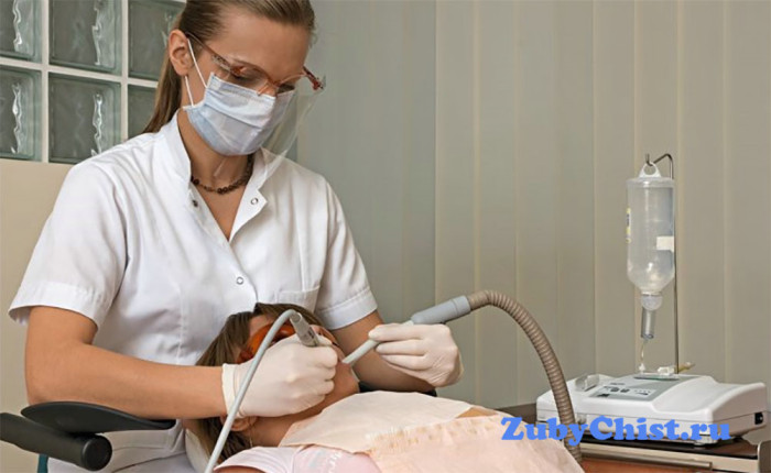 Чистка ультразвуком зубов