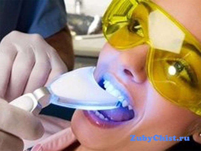 Процедура установки скайсов