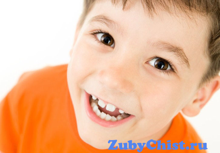 Нарушение прикуса