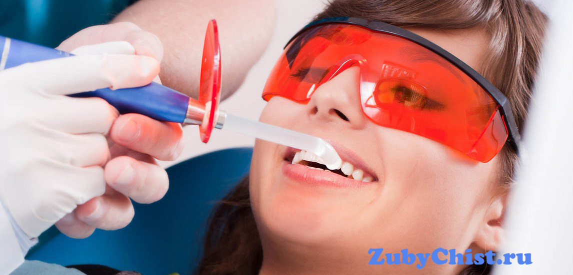 Ультразвуковая чистка зубов