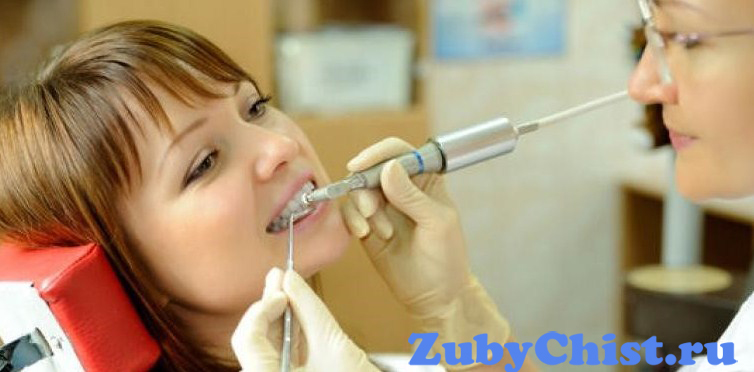 Профессиональное проведение ультразвуковой чистки