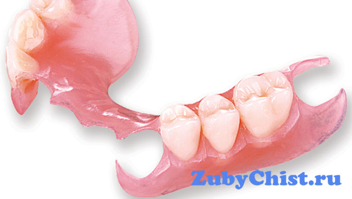 Акриловые зубные протезы