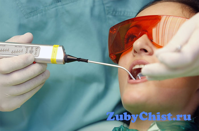 Лазерный способ