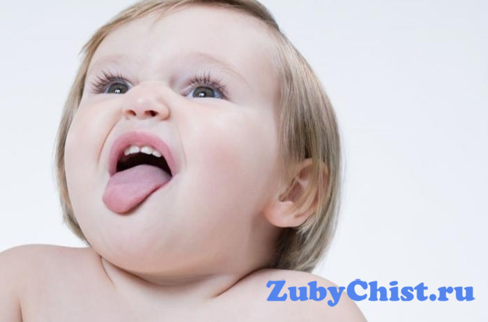 Макроглоссия у ребенка