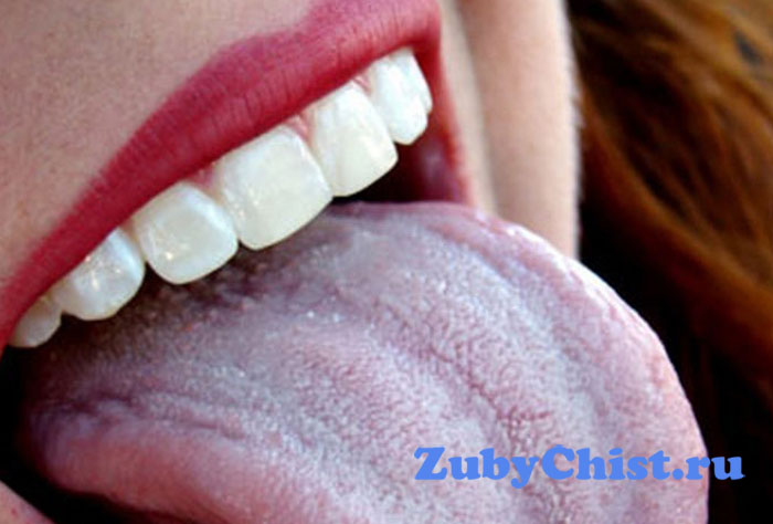 Серый налет на языке