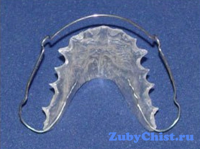 Ортодонтическая пластинка