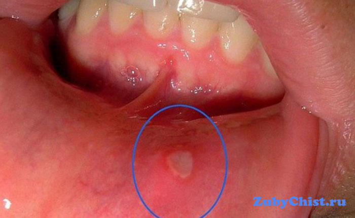 Аллергический