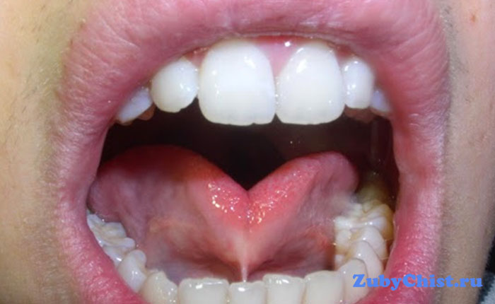 Полость рта