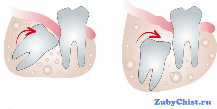 Зуб под зубом