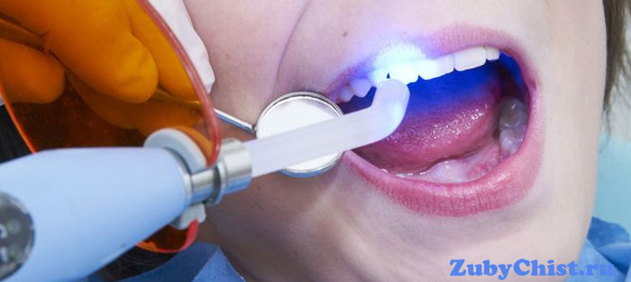 Лечение лазером