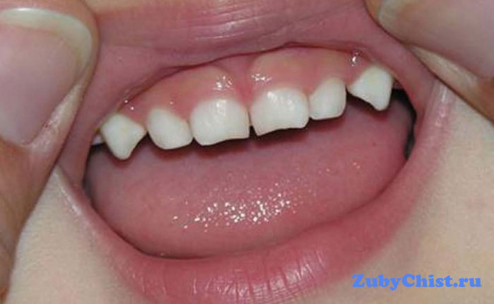 Молочные зубы