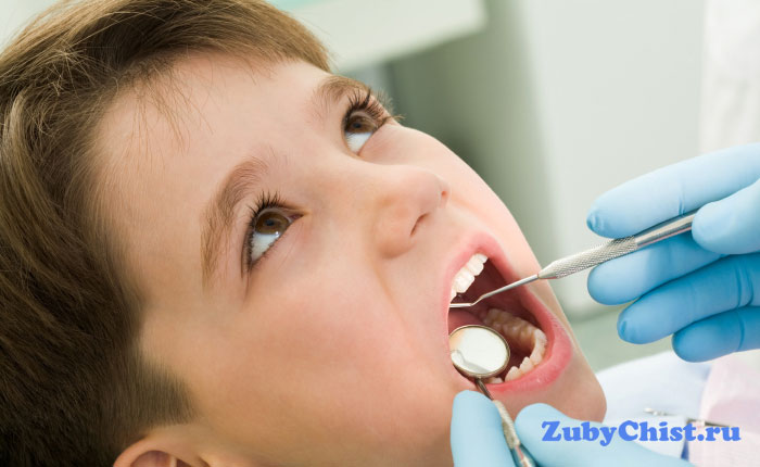 Пломбирование