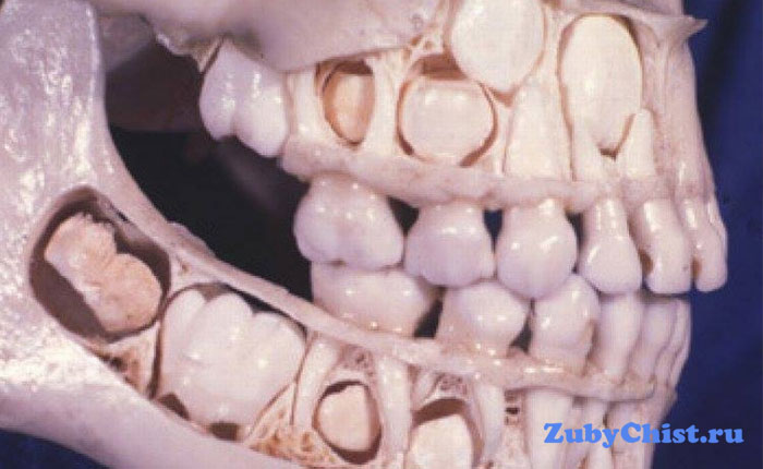 Череп ребенка до выпадения зубов
