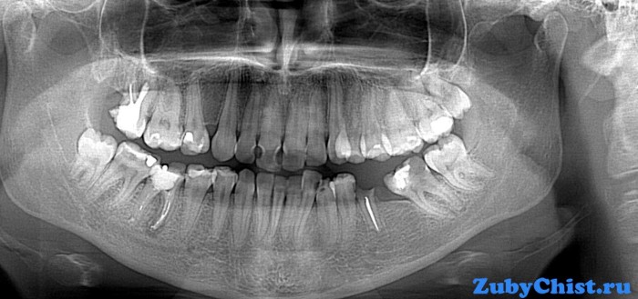 На этапе диагностики