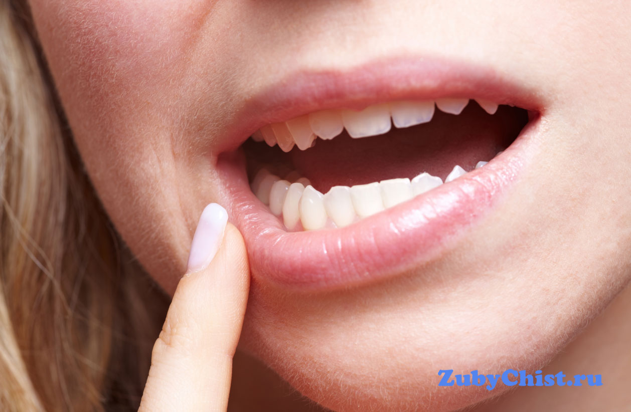 Девушка чешет десну