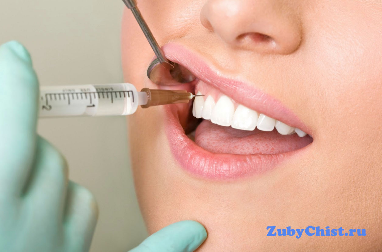 Местная анестезия