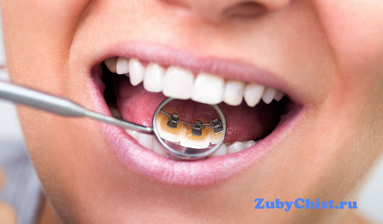 Не забывайте про посещение врача