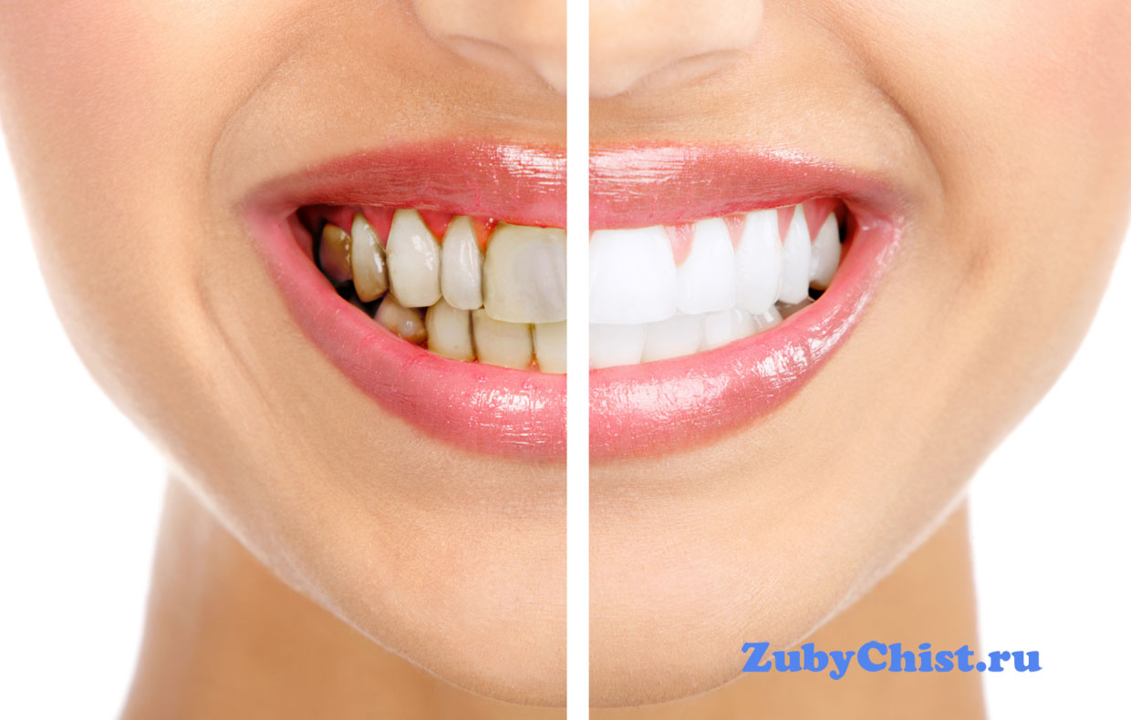 Посмотрите какая разница с камнями и без