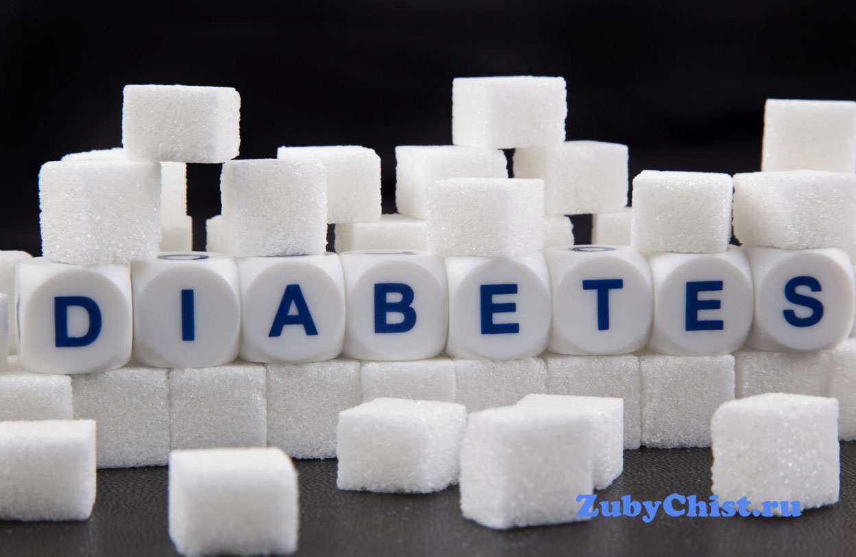 При сахарном диабете имплантация противопоказана