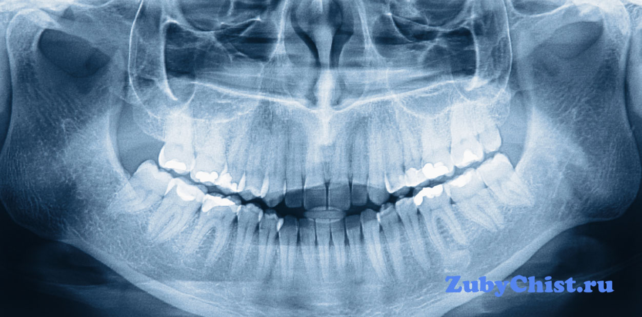 Снимок зубов